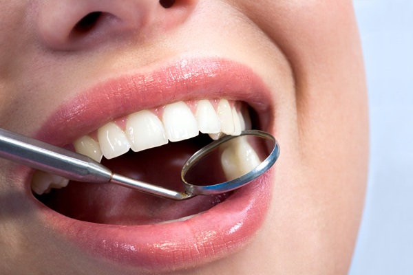 Types Of Dental Fillings By A General Dentist