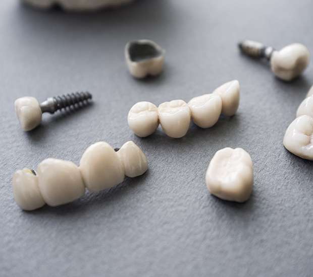 Fontana The Difference Between Dental Implants and Mini Dental Implants