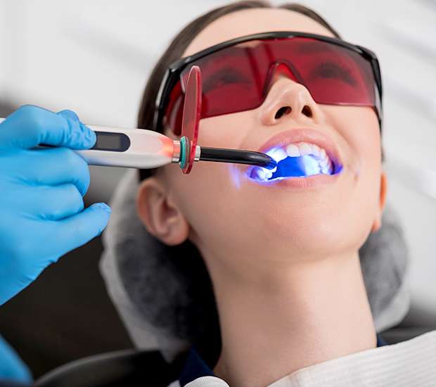 Fontana Professional Teeth Whitening