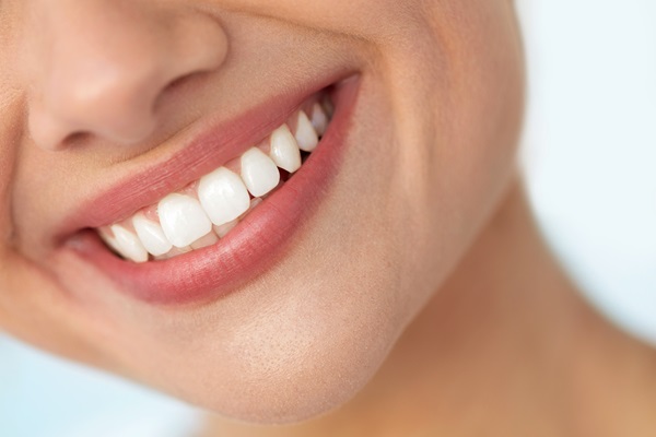 Teeth Whitening And Your Smile Makeover