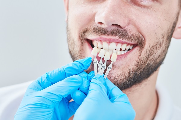 How Dental Veneers Can Strengthen Your Teeth